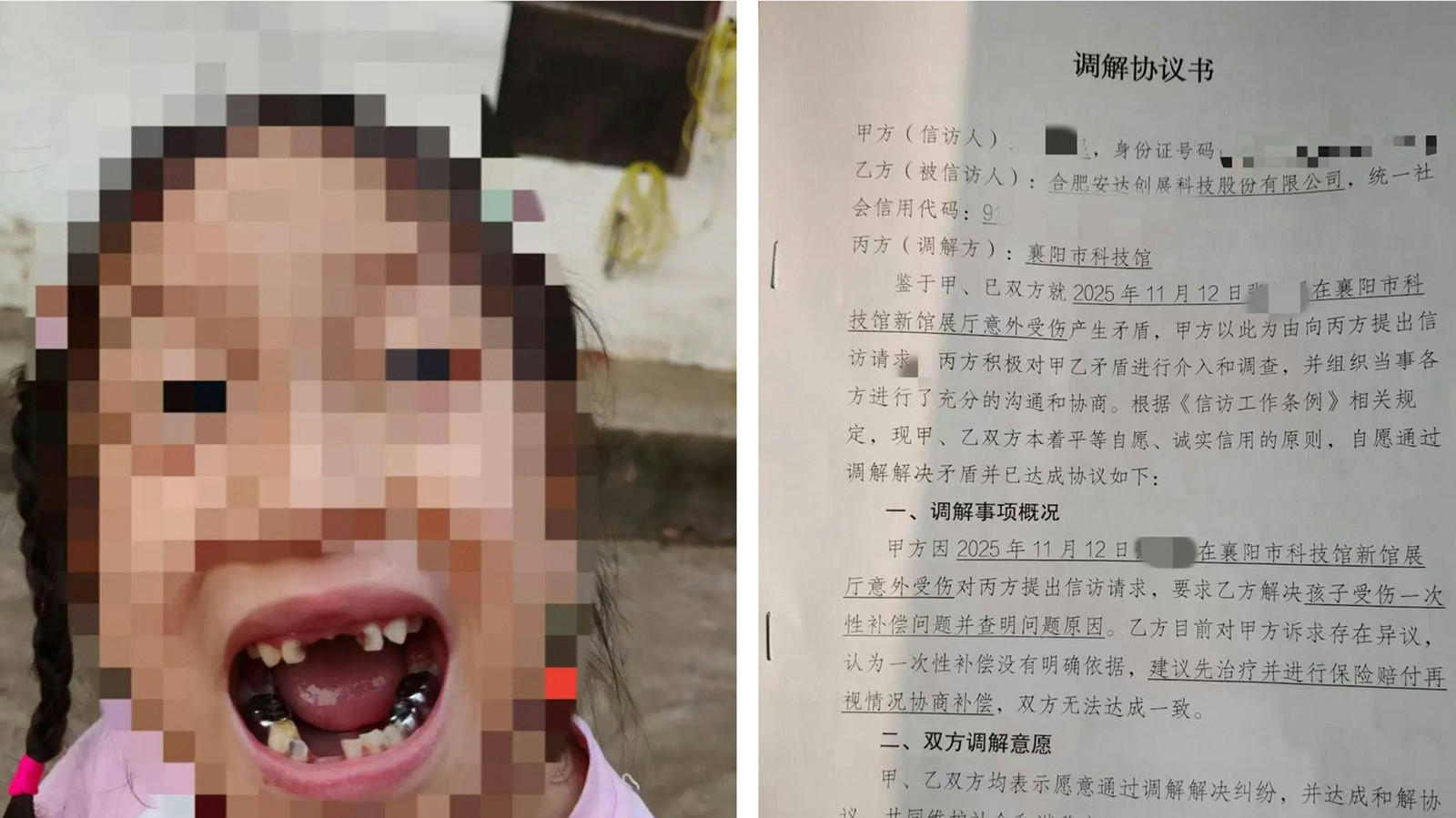 5歲女童被宇樹機器人一腳踢面　4顆乳牙脫落　索賠15萬纏訟9個月終和解