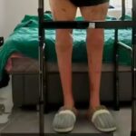 51歲工人雙腿遭機器切斷　手術接回20個月後重新行走